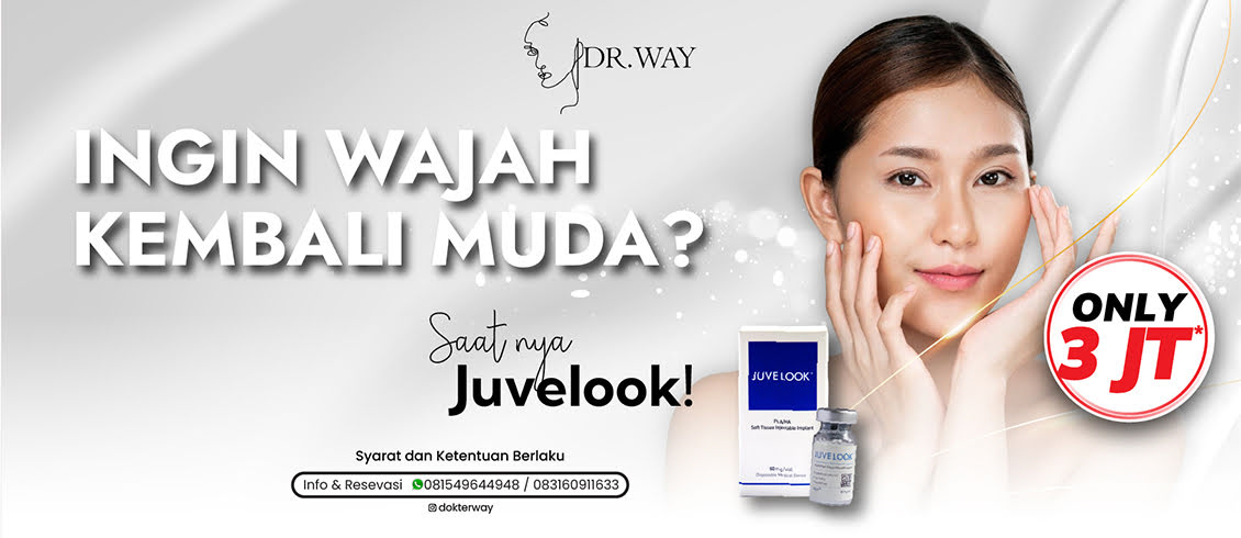 Juvelook
